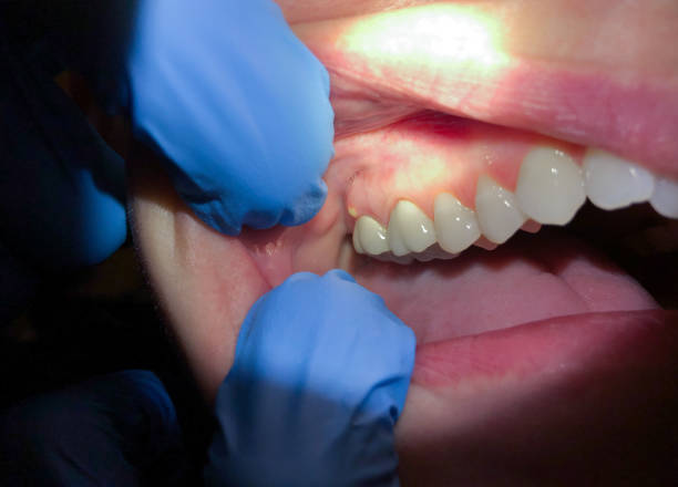 Best Emergency Orthodontic Repairs in Midlothian, TX