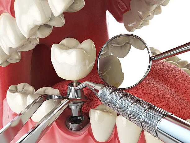 Best Emergency Dental Care for Sports Injuries in Midlothian, TX