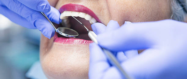 Best Broken or Chipped Tooth Repair in Midlothian, TX